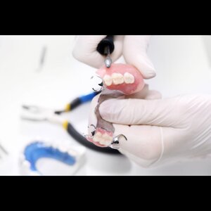 Camila prothetischemondzorg image 6