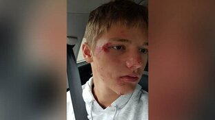 Jongen (15) uit het niets van fiets getrapt door scooterrijder